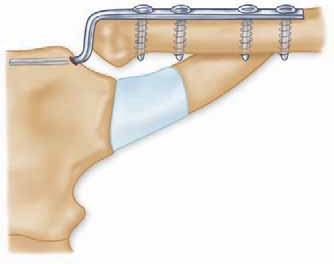 افضل دكتور عظام في اليمن