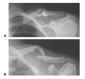 اختبر معلوماتك: أسئلة القدم والكاحل لتحدي خبيرك الطبي