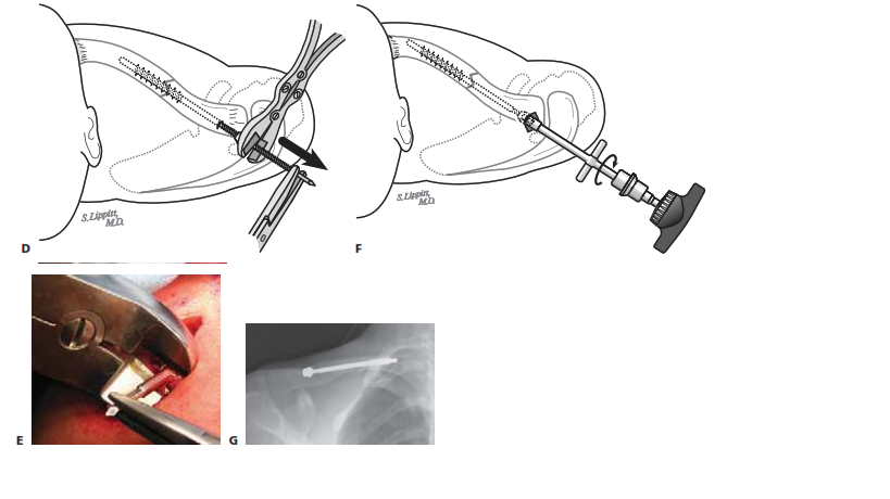 دكتور جراحة العظام والمفاصل صنعاء