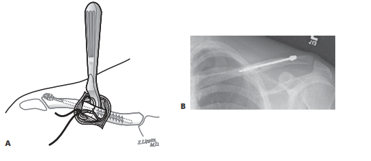 دكتور جراحة العظام والمفاصل صنعاء
