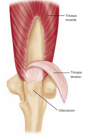 Illustration of surgical approaches elbow - Dr. Mohammed Hutaif