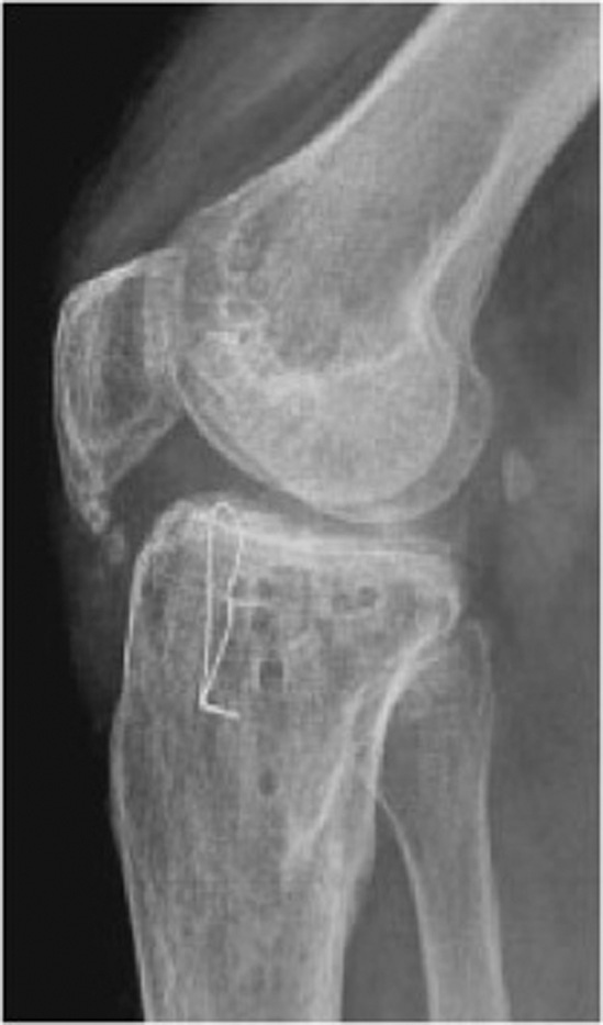 افضل دكتور عظام في اليمن