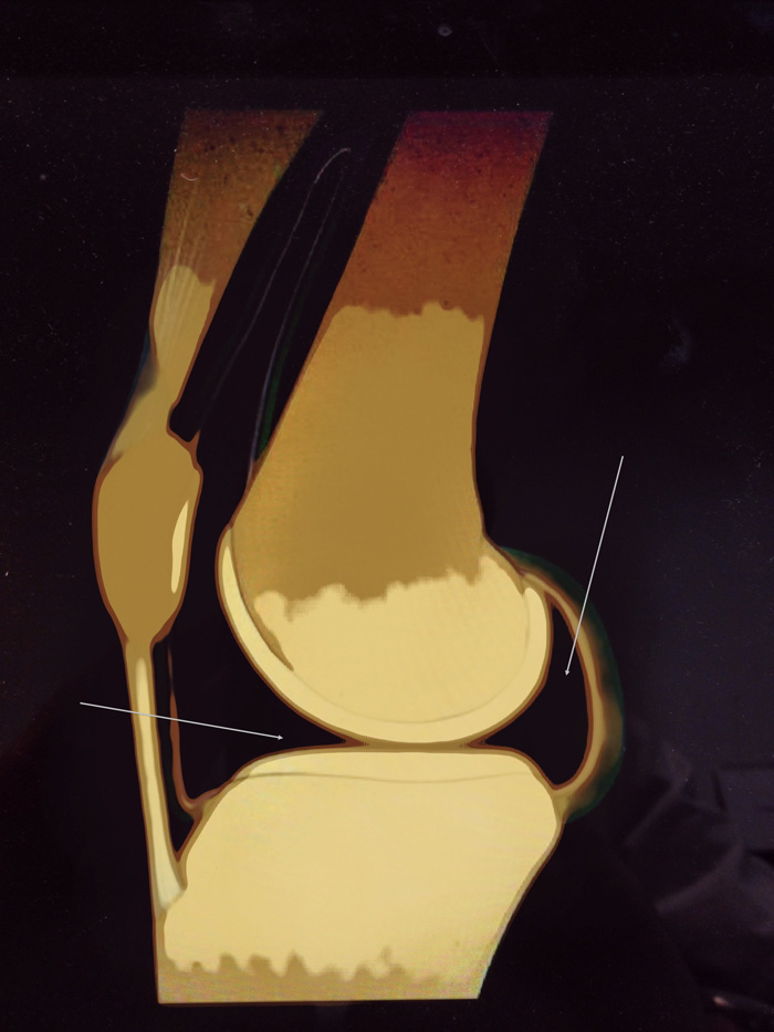 افضل دكتور عظام في اليمن