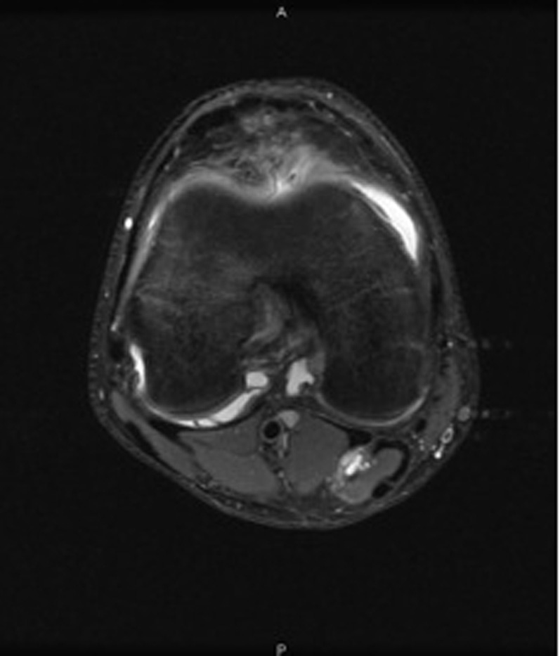 افضل دكتور عظام في اليمن