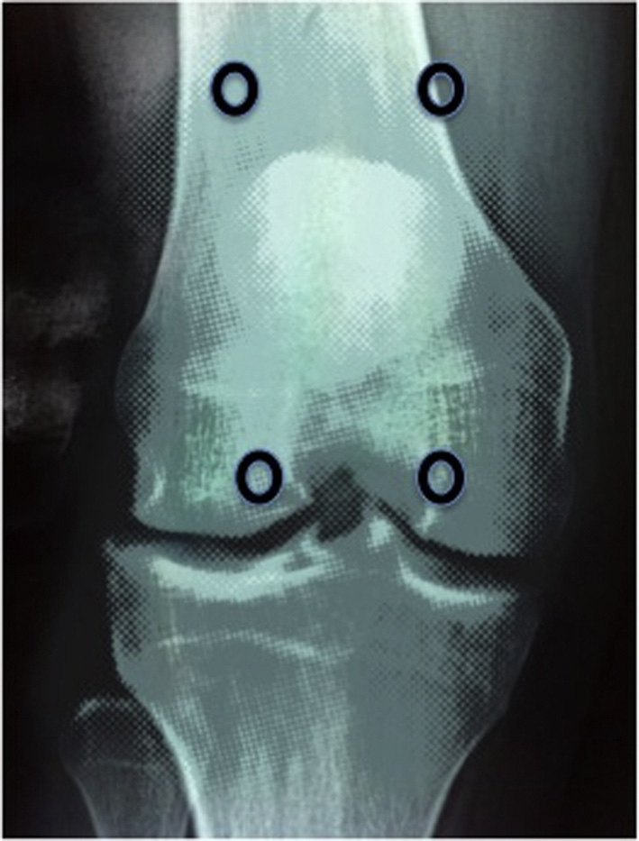 افضل دكتور عظام في اليمن