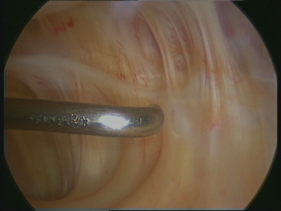 افضل دكتور عظام في اليمن