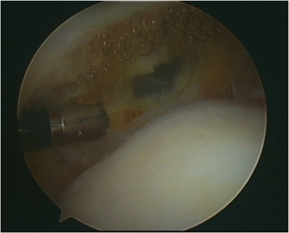 افضل دكتور عظام في اليمن