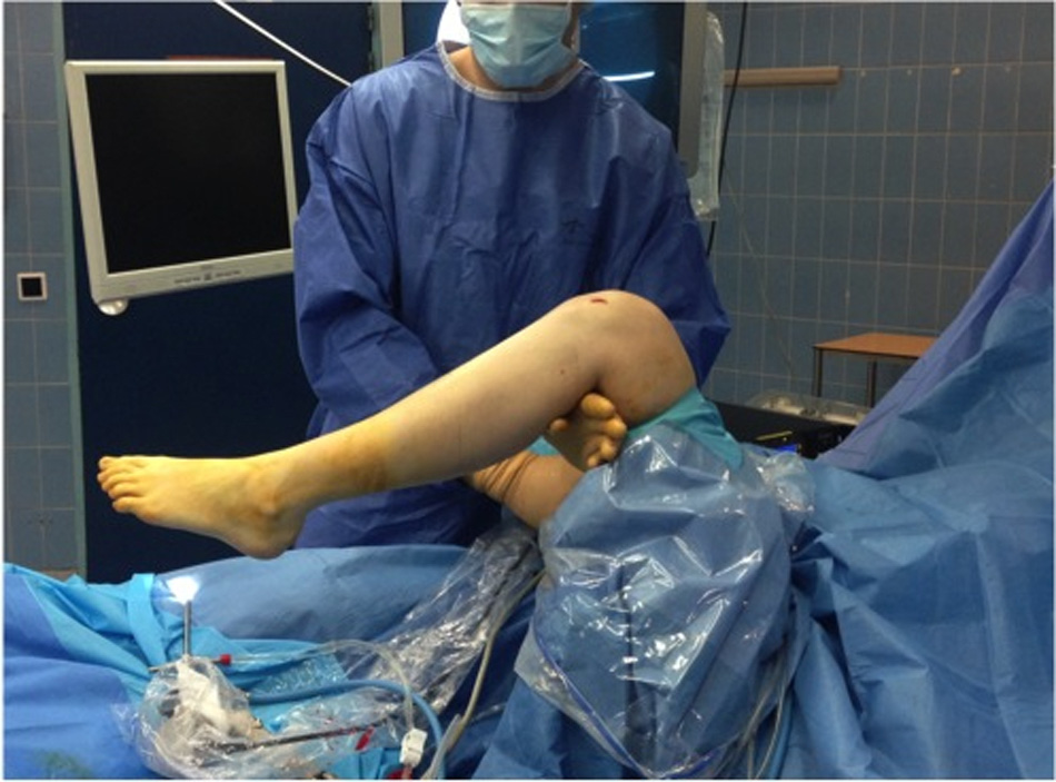 افضل دكتور عظام في اليمن