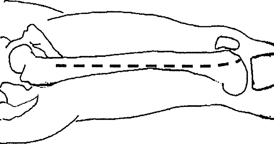 افضل دكتور عظام في اليمن