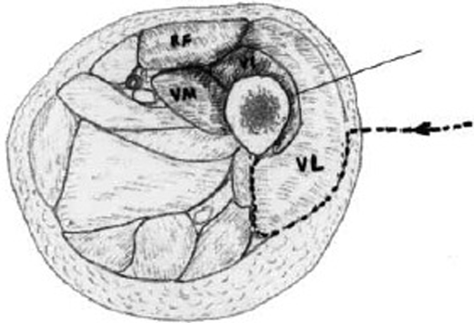 افضل دكتور عظام في اليمن