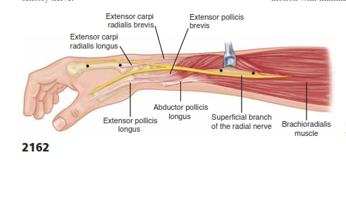 Extensor carpi radialis brevis Extensor carpi radialis longus Extensor pollicis brevis Abductor pollicis 2162 Extensor pollicis longus longus Superficial branch of the radial nerve Brachioradialis muscle