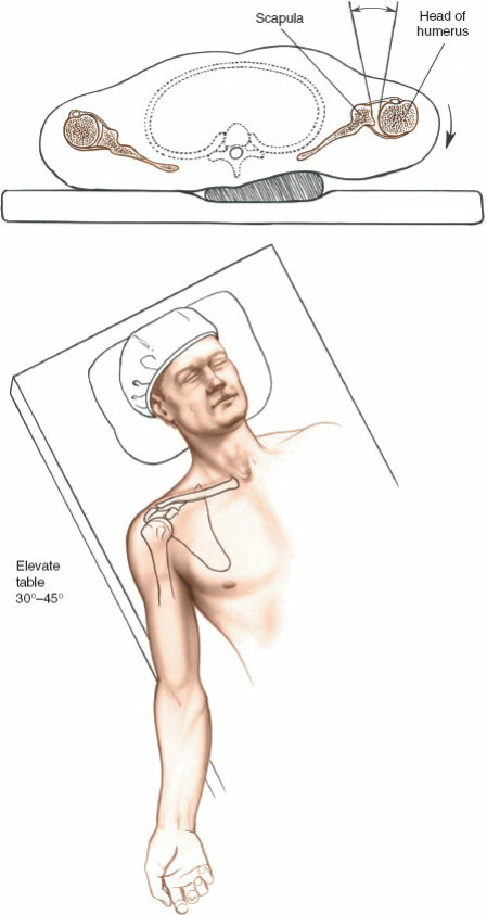 Mastering the Anterior Approach for Tendon of the Long Head Repair