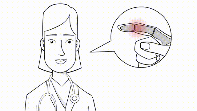 7 Effective Ways to Fix Your Finger Sprain Fast (With Pictures)