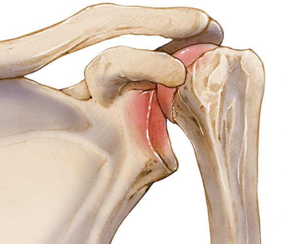 Superior Glenohumeral Dislocation Mechanism: Injury to Recovery Guide