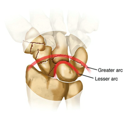 Mastering Radiology Interactive: Ace Perilunate Dislocation Cases