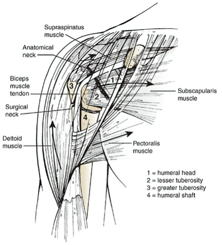 Proximal Humerus Fracture: Your Essential Management Guide