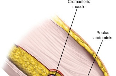 Illustration 64 for Pelvis & Acetabulum Approaches: Unlocking the Posterior Superior Iliac
