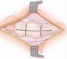 Illustration 17 for J. W. Thomas on Snapping Hip: Causes, Cures & Relief