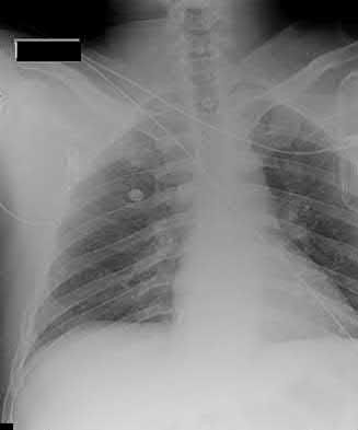 Illustration 154 for OrthoCash: Trauma MCQs & Cases for a yearold woman