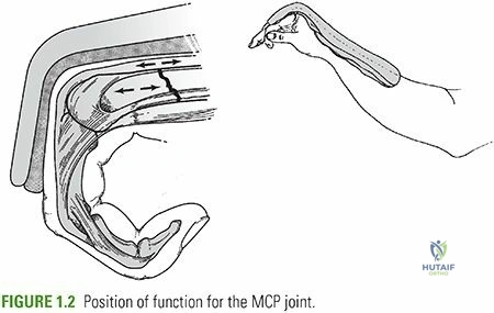 Illustration of closed reduction casting - Dr. Mohammed Hutaif