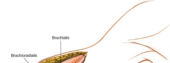 Illustration 61 for Mastering the Approach to the Distal Humerus: Safety & Skills