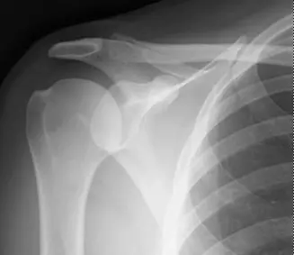 آلام الكتف والمرفق: دليلك الشامل للتشخيص الدقيق والعلاج الفعال في صنعاء مع الأستاذ الدكتور محمد هطيف