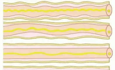 إصابات الأعصاب الطرفية المستمرة: دليلك الشامل لاستعادة الحركة والإحساس مع الأستاذ الدكتور محمد هطيف