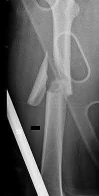 Illustration 110 for OrthoCash: Trauma MCQs & Cases for a yearold woman