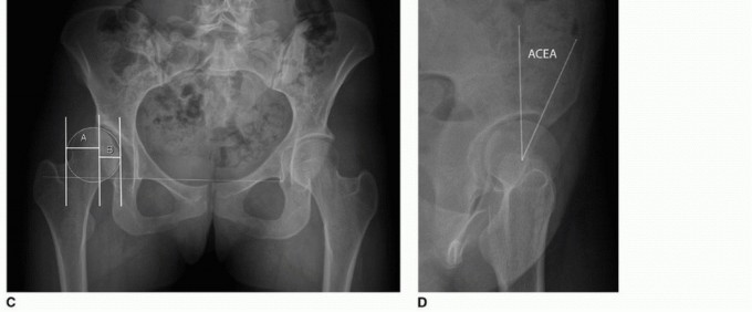 وصف طبي دقيق للمريض