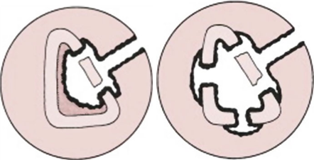 Illustration 20 for Decoding Von Willebrand Factor: Fundamental Basic Science Principles