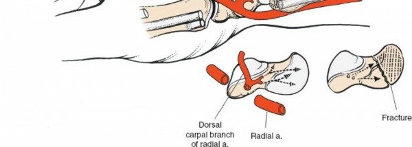 Illustration 201 for Essential Surgical Approaches: Uncover Every Aspect of the Wrist