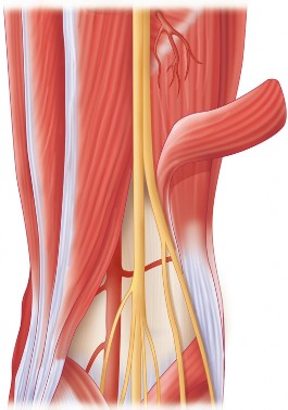 Illustration 28 for Hinged Total Knee: The Salvage Solution for Challenging Cases
