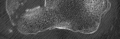 Illustration 28 for OrthoCash: Trauma MCQs & Cases for a yearold woman