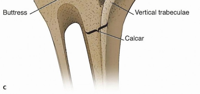 Illustration 6 for Achieve Optimal Femoral Head Fixation with Cephalomedullary Nailing