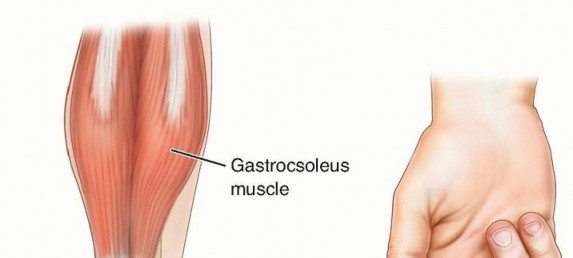Achilles Tendon Open Lengthening: What to Expect & Recovery