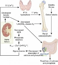 Illustration of normal bone metabolism - Dr. Mohammed Hutaif