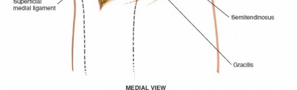 Illustration 72 for Mastering Knee Approaches: Spotlight on Superficial Medial Ligament