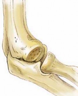 Illustration 36 for Precision Arthroscopy for Chondral Injuries & OCD: Direct Lateral Portal