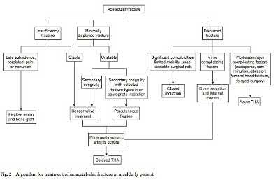 Illustration 61 for OrthoCash: Trauma MCQs & Cases for a yearold woman