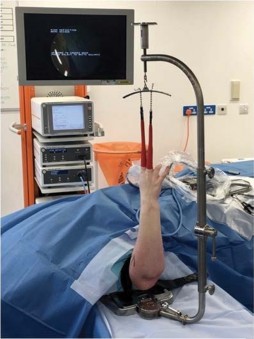 Illustration 1 for Mastering Wrist Surgery: Actions That Must Be Taken for Success