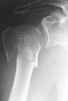 Illustration 69 for OrthoCash: Trauma MCQs & Cases for a yearold woman