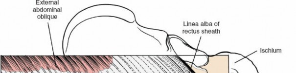 Illustration 94 for Approach to the Lumbar Spine: Mastering Techniques & Anatomy