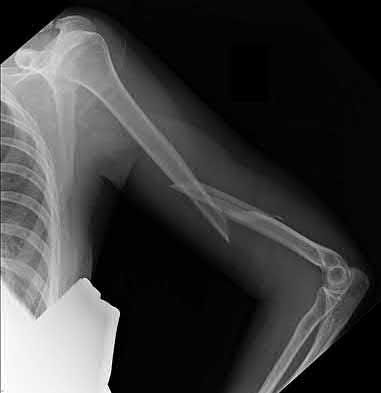 Illustration 179 for OrthoCash: Trauma MCQs & Cases for a yearold woman