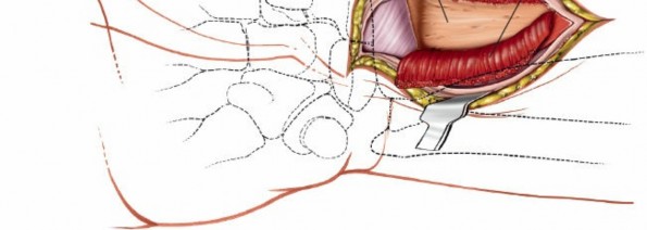 Illustration 60 for Essential Surgical Approaches: Uncover Every Aspect of the Wrist