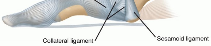 Mastering Arthrodesis of the First MTP Joint: Key Insights