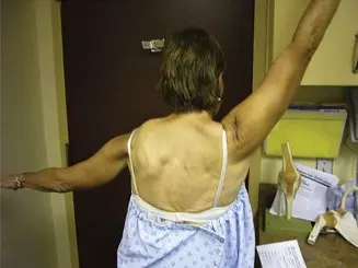 جنف الكتف وشلل العصب الصدري الطويل: التشخيص، الأسباب والعلاج مع الأستاذ الدكتور محمد هطيف في صنعاء