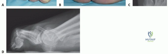 6 TO 9 Sports Medicine CASES