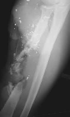 Illustration 22 for OrthoCash: Trauma MCQs & Cases for a yearold woman