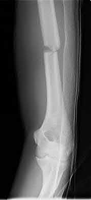 Illustration 174 for OrthoCash: Trauma MCQs & Cases for a yearold woman