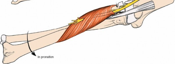 Illustration 69 for Mastering Elbow Approaches: Applied Surgical Anatomy for Precision